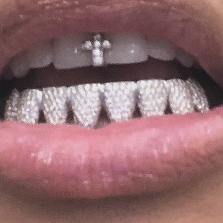 Ким Кардашьян украсила зубы бриллиантами