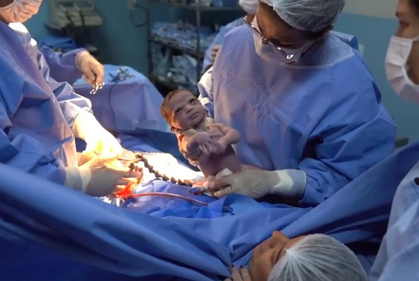 Новорожденная малышка одарила докторов таким взглядом, что им стало не по себе